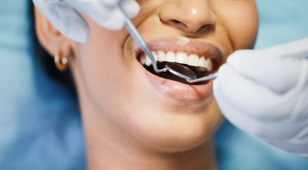 Best Emergency Wisdom Teeth Removal in Falmouth Foreside, ME
