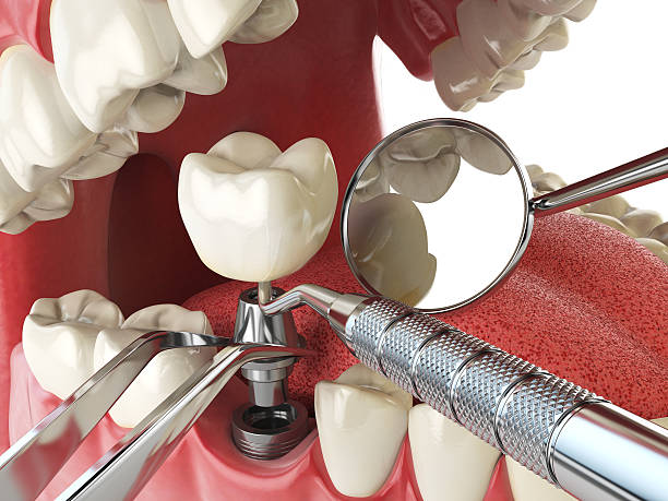 Reliable ME Emergency Dentist Solutions